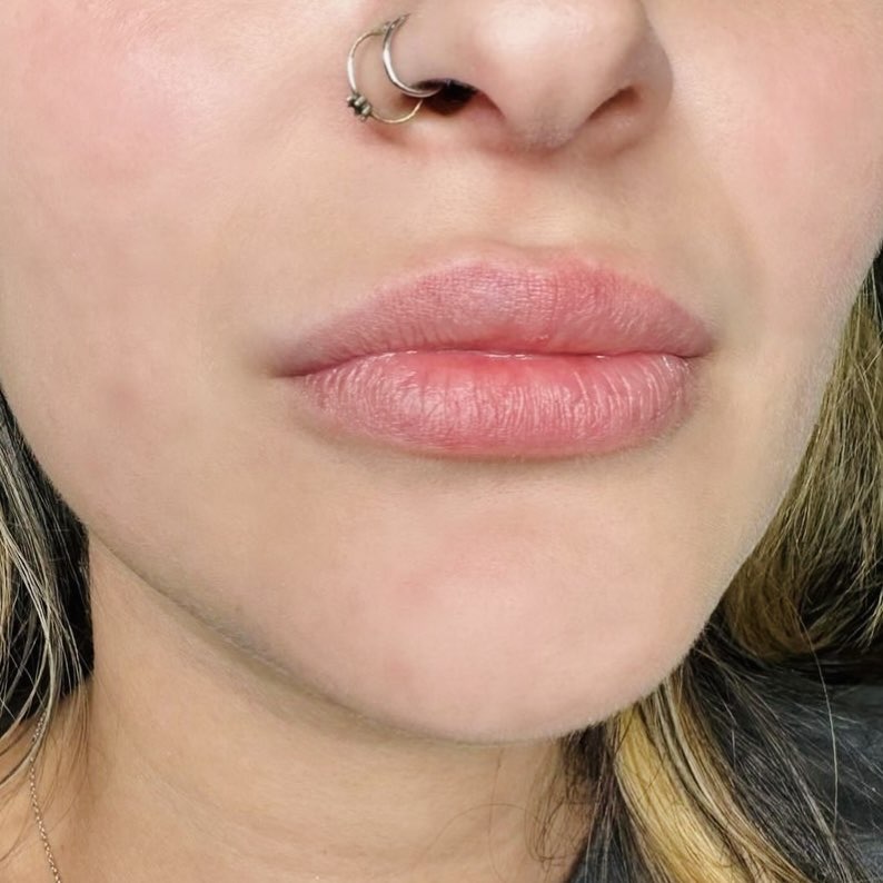 Lips