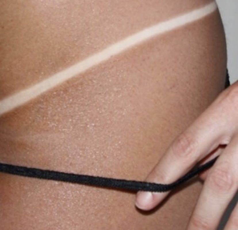Tan lines